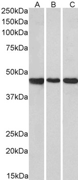 SLCO1B3 Antibody