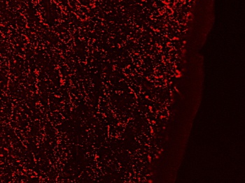 PROKR2 Antibody