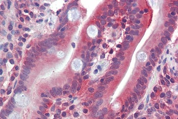 TAF7L Antibody