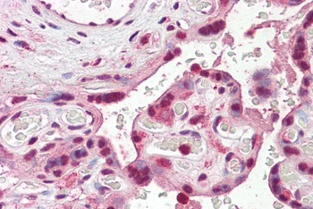 PRKCDBP Antibody