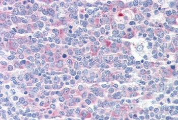 MOZ Antibody