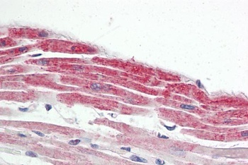 NOXA Antibody