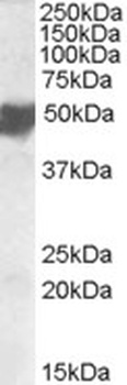 CPT1C Antibody