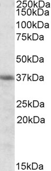 CLIP1 Antibody