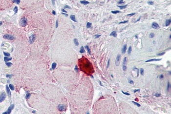 THBS3 Antibody