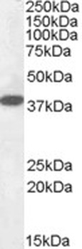 NUAK1 Antibody