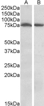 STK39 Antibody