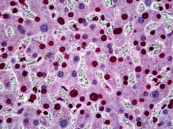 SGK1 Antibody [3G8]