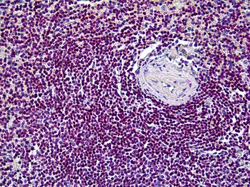 CDK6 Antibody [8H4]