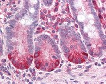 IL-8 Receptor B Antibody, Monoclonal