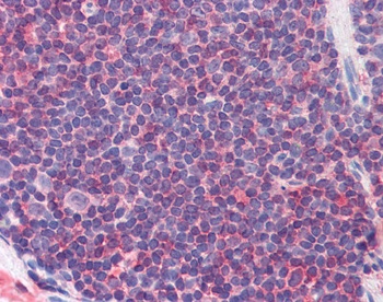 IL-7 Receptor (phospho Tyr449) Antibody