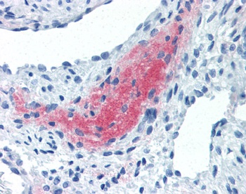 LEFTY2 Antibody [7C5G1H6H10]