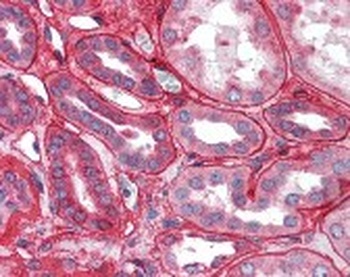 Collagen IV Antibody