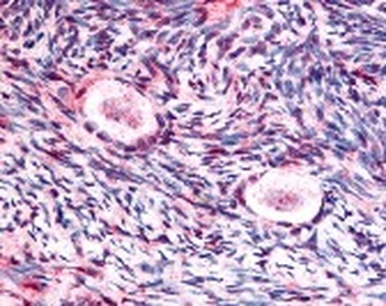 GSK3B (phospho Ser9) Antibody
