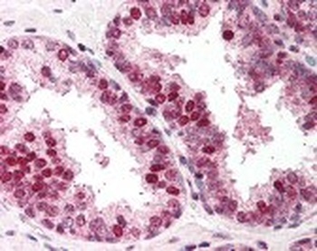 RAD52 Antibody