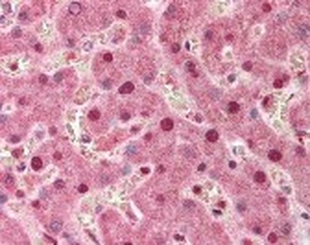 PPP1R13L Antibody