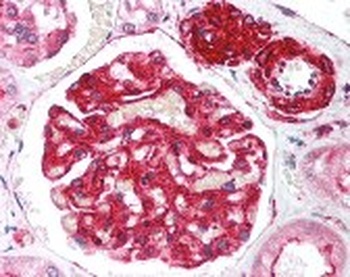 RIF1 Antibody