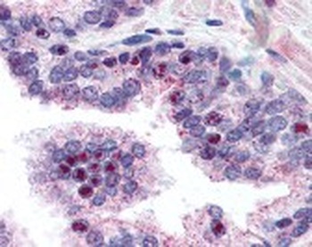 NEK2 Antibody
