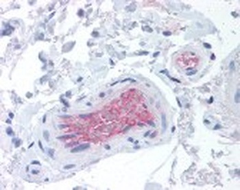CFI Antibody [OX-21]