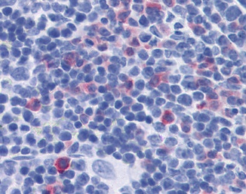 IL-17 Antibody [TC11-18H10]