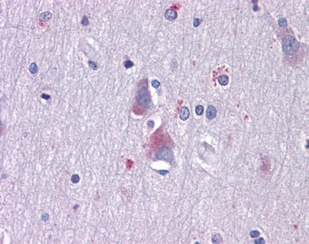 AXL Antibody [7E10]