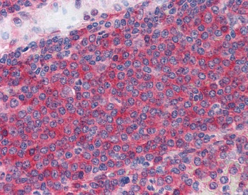 CAMK2 (phospho Thr286) Antibody