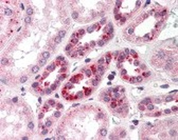 NOTCH2 Antibody