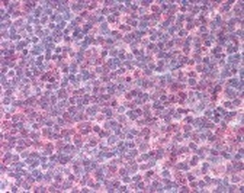 IL-6 Antibody [6D9A1,6C12B1]