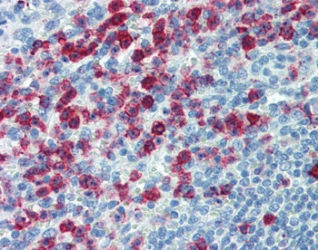 SELPLG Antibody [HECA-452]