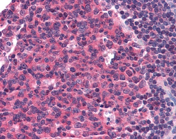 CCR5 Antibody [T21/8]