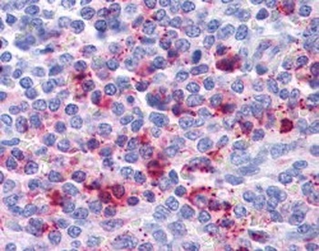 IL-8 Receptor B Antibody
