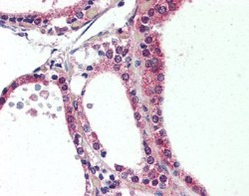 NR1D2 Antibody