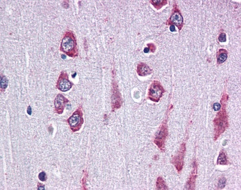 RAPSN Antibody