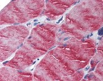 Myosin 5B Antibody
