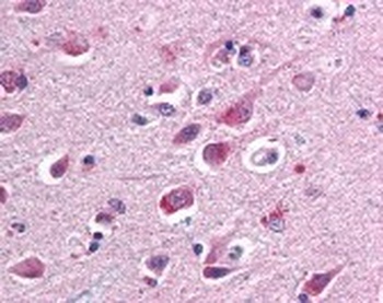 SARM1 Antibody [Sarmy-1]