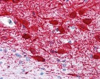MAP2 Antibody [MT-08]