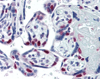 PARP1 Antibody [A6.4.12]