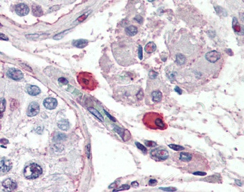 Fc Epsilon Receptor 1 Antibody [9E1]
