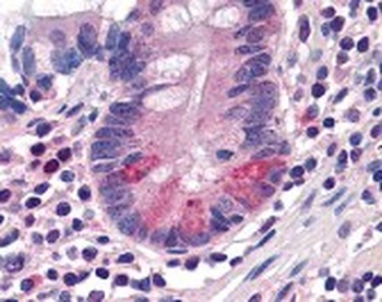 SLC15A1 Antibody