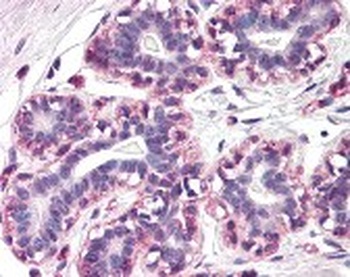 RAMP3 Antibody