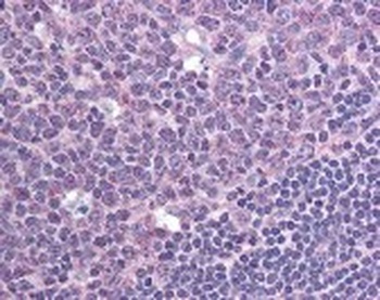 CXCR7 Antibody