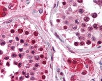 Replication Protein A3 Antibody [111]