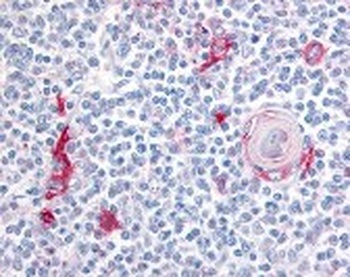 Integrin alpha 4 Antibody