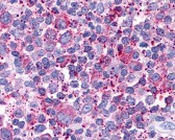CX3CR1 Antibody