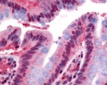 GPR160 Antibody