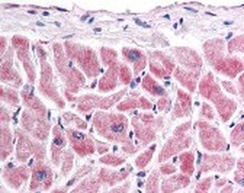 Frizzled 7 Antibody