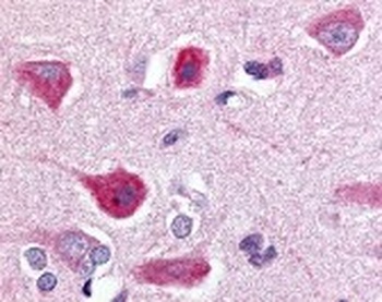 GPR77 Antibody