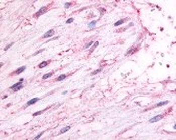 Oxytocin Receptor Antibody