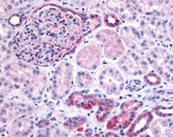 PIB5PA Antibody