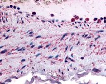 PTPMT1 Antibody